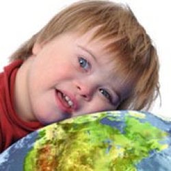 تغذیه معلولین ذهنی تغذیه معلولین ذهنی